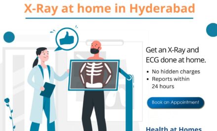 Revolutionizing Healthcare: X-Ray Services at Your Doorstep with Health at Homes in Hyderabad!