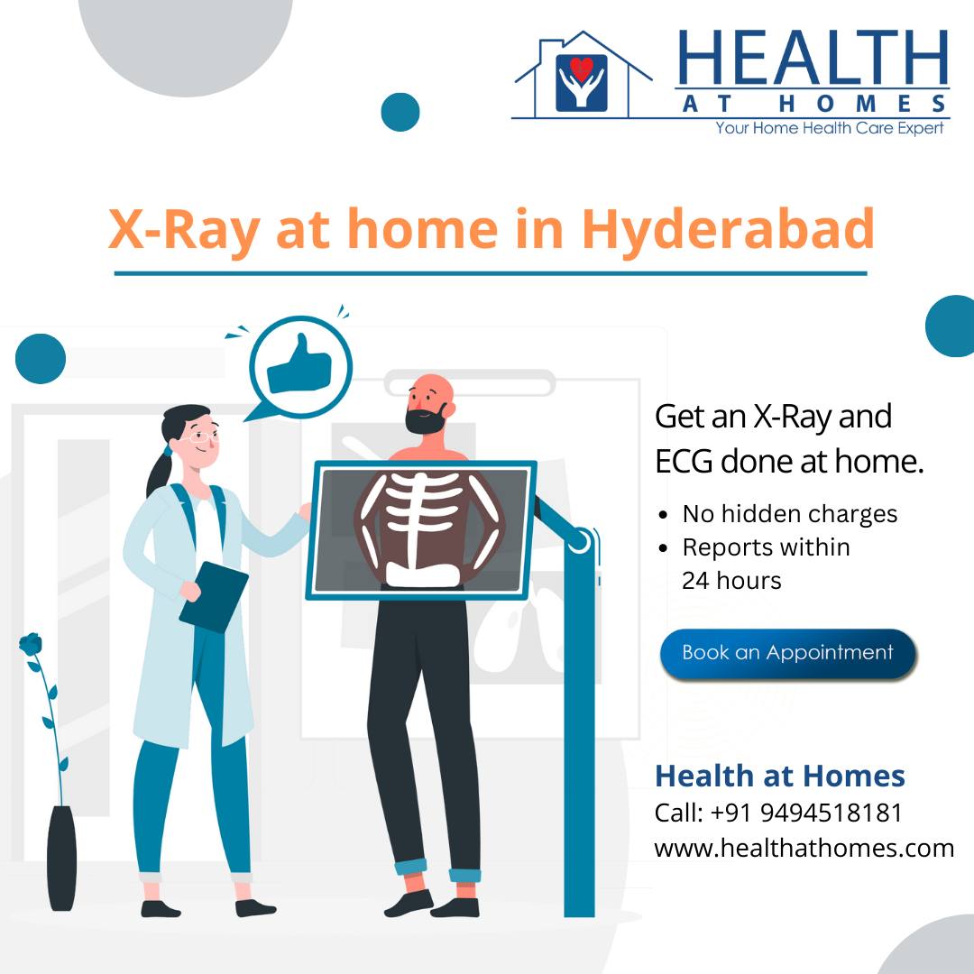 Revolutionizing Healthcare: X-Ray Services at Your Doorstep with Health at Homes in Hyderabad!