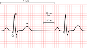 Understanding the Vital Significance of ECG in Healthcare